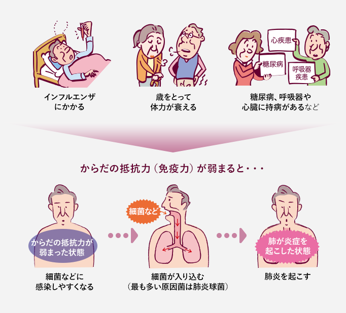 抵抗力(免疫力)が弱まると、細菌などに感染しやすくなる