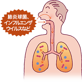 肺炎球菌、インフルエンザウイルスなどが口腔・鼻腔から肺へ