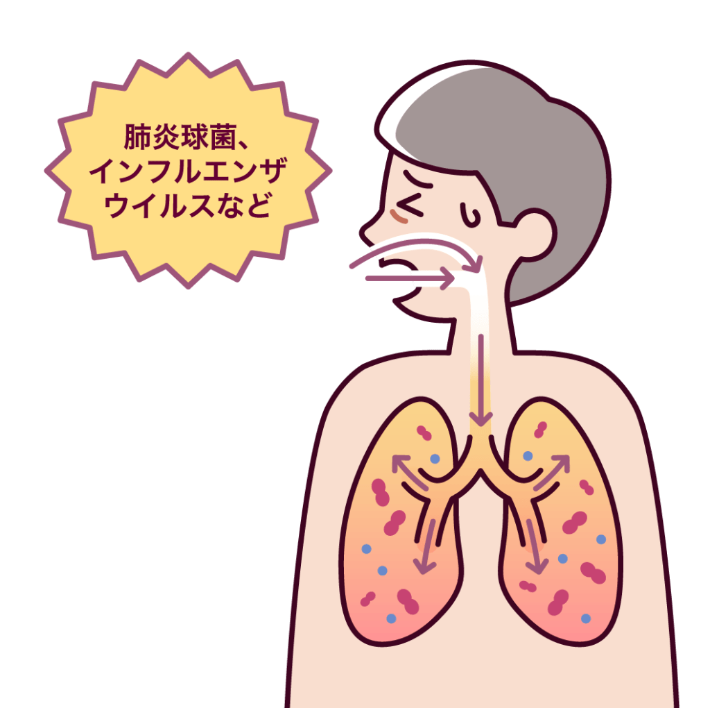 肺炎球菌、インフルエンザウイルスなどが口腔・鼻腔から肺へ