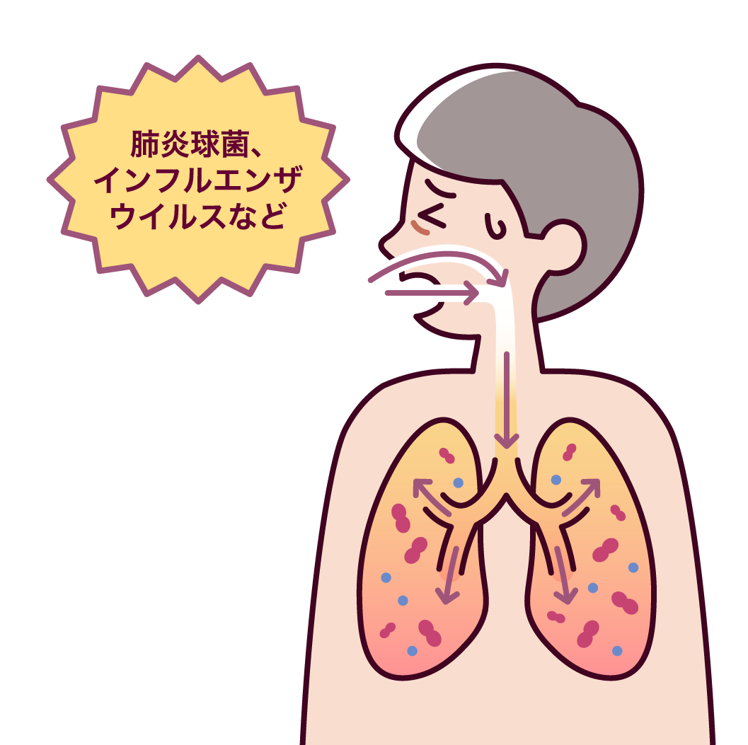 肺炎球菌、インフルエンザウイルスなどが口腔・鼻腔から肺へ